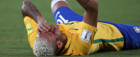neymar-down-bleeding-epa091016